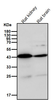 Rabbit Monoclonal to AGTR2