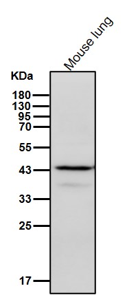 Rabbit Monoclonal to AGTR2