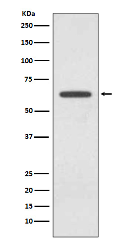 Glutaminase