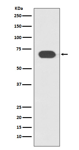 TCF7L2