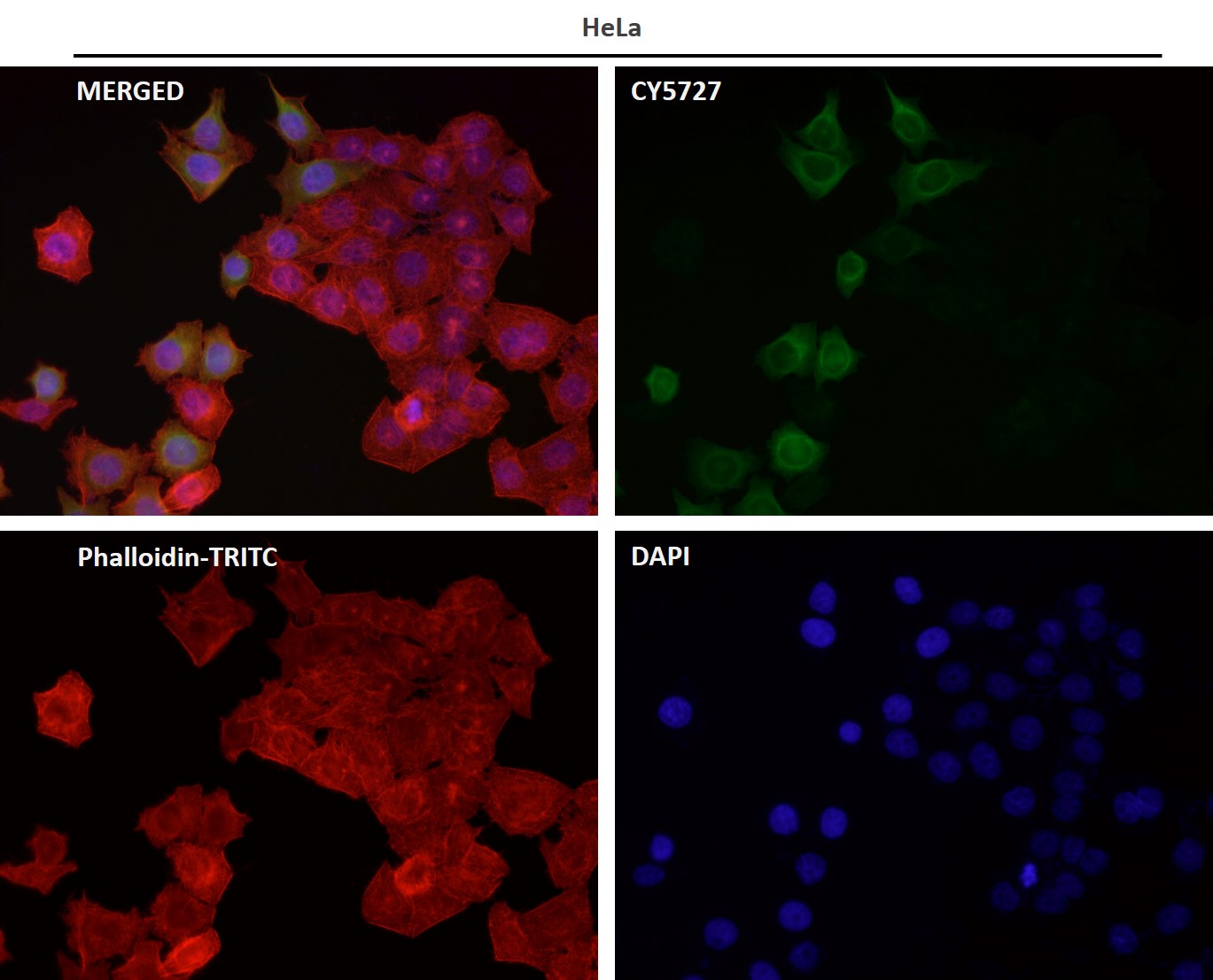 Rabbit Monoclonal to ADIPOR1