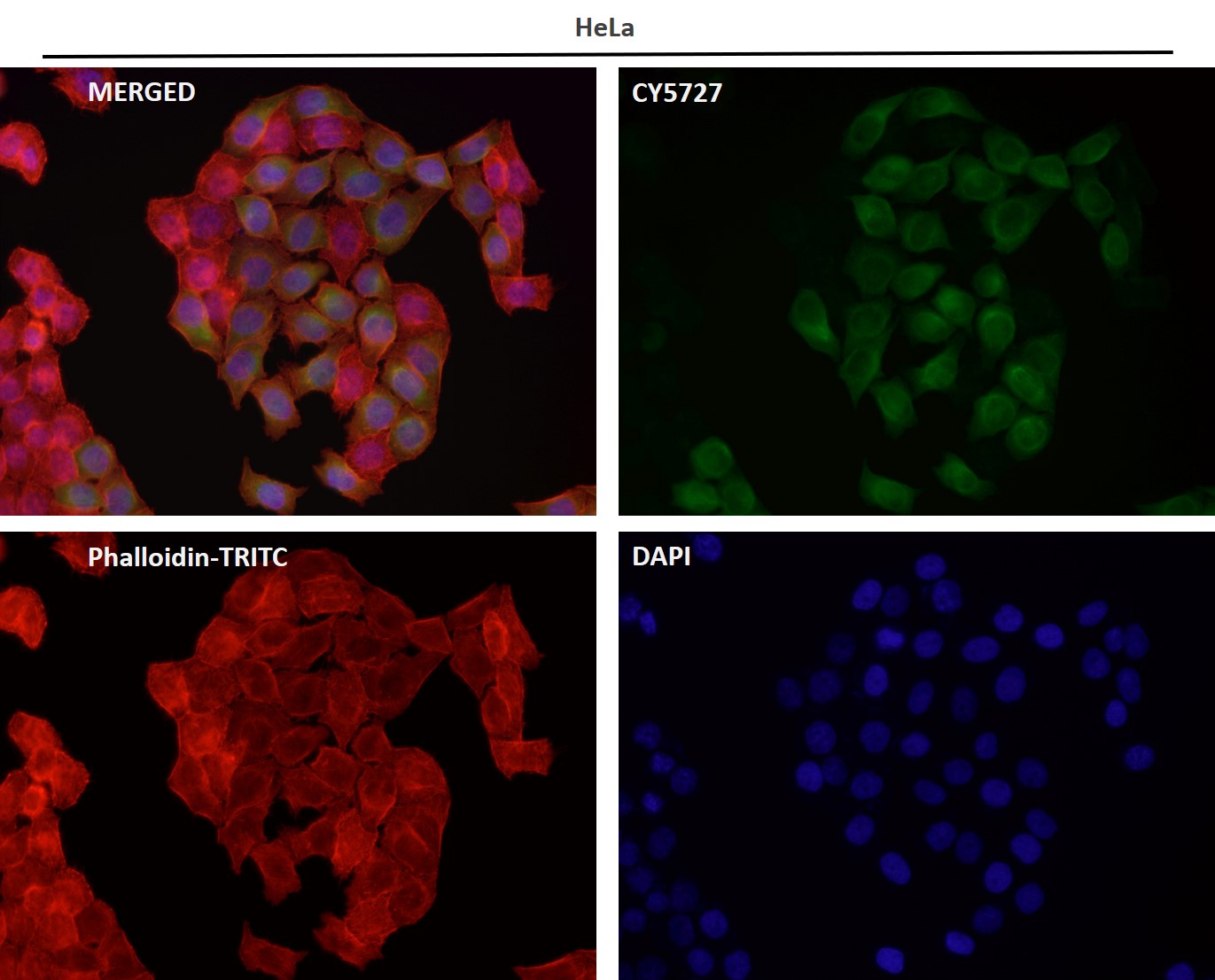 Rabbit Monoclonal to ADIPOR1
