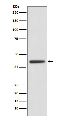 Rabbit Monoclonal to ADIPOR1