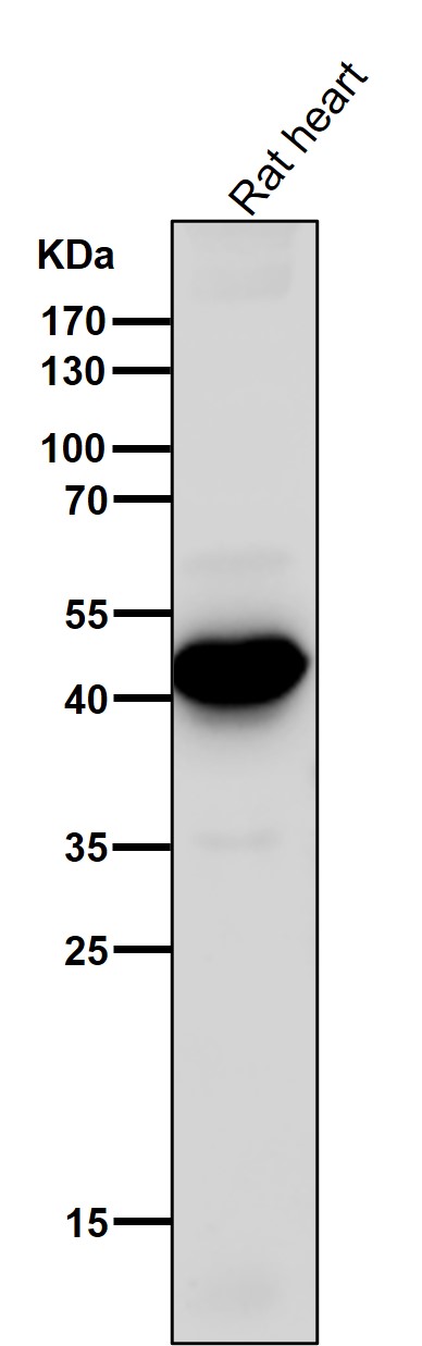 Rabbit Monoclonal to ADIPOR1