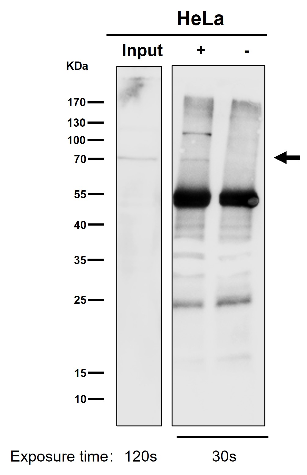 Rabbit Monoclonal to PKC