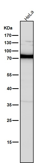 Rabbit Monoclonal to PKC