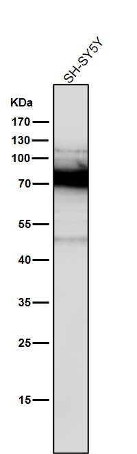 Rabbit Monoclonal to PKC