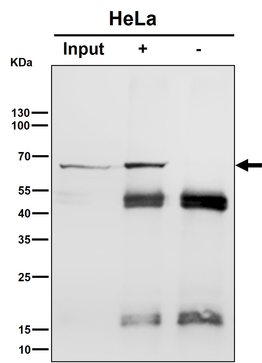 Rabbit Monoclonal to Hsp70