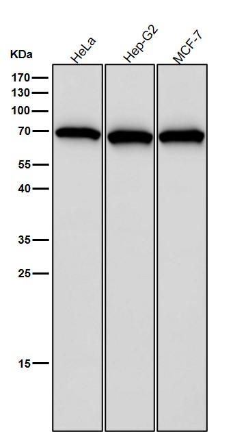 Rabbit Monoclonal to Hsp70
