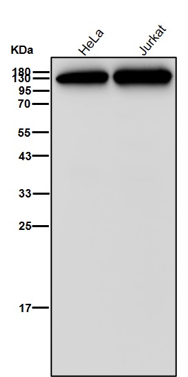 Rabbit Monoclonal to NEDD4-2