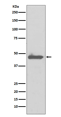 Rabbit Monoclonal to Caspase 5