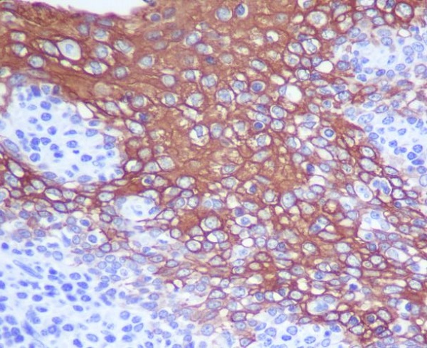 Rabbit Monoclonal to Cytokeratin 13