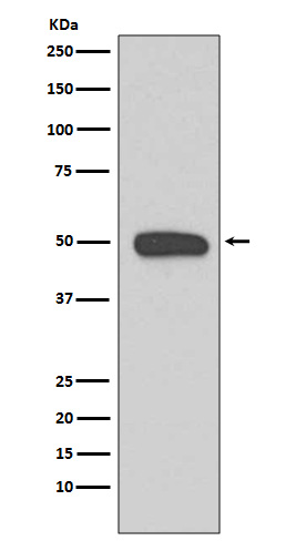 Cytokeratin 13