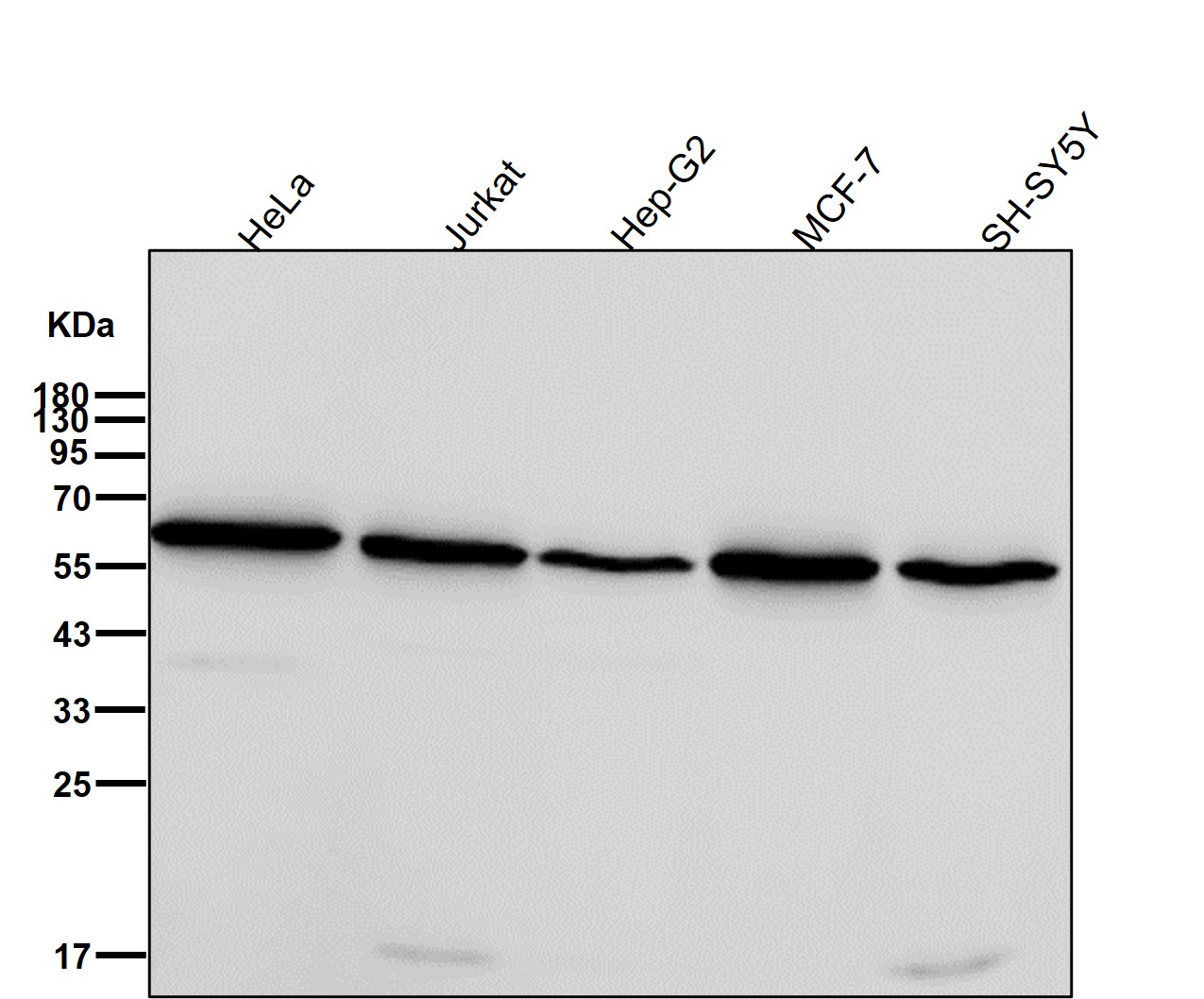 Retinoic Acid Receptor alpha