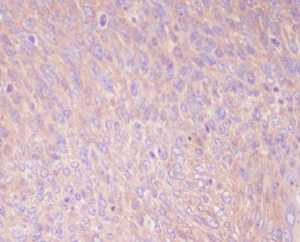 Rabbit Monoclonal to PKM2