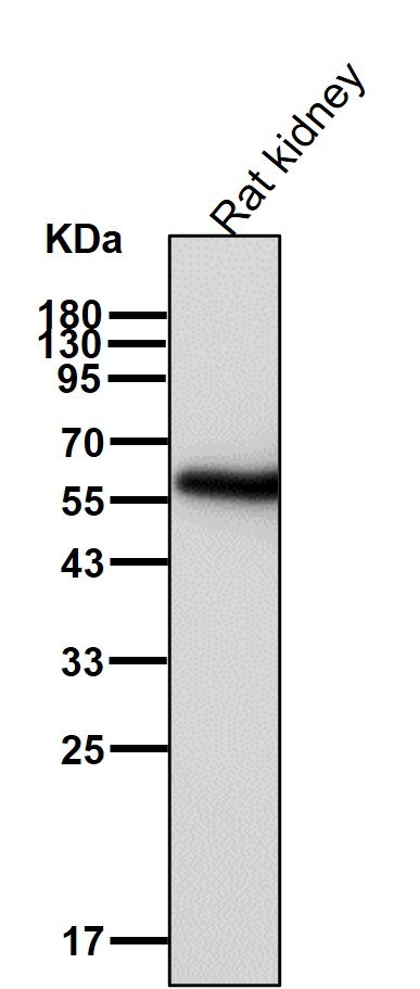 Rabbit Monoclonal to PKM2