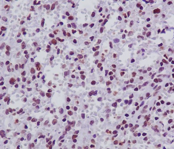 Rabbit Monoclonal to FANCD2