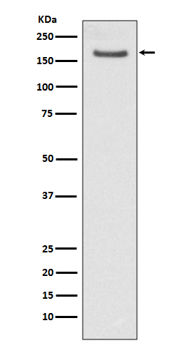 Rabbit Monoclonal to FANCD2