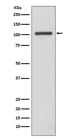 INPP4B