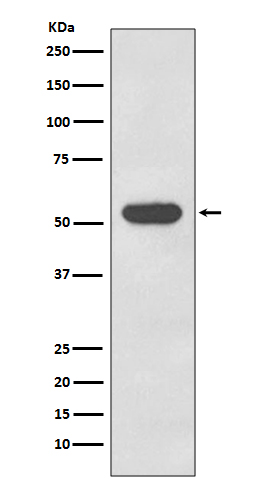 Rabbit Monoclonal to Cytokeratin 4