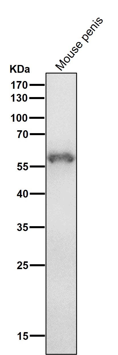Cytokeratin 4