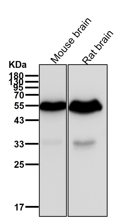 Rabbit Monoclonal to MMP11