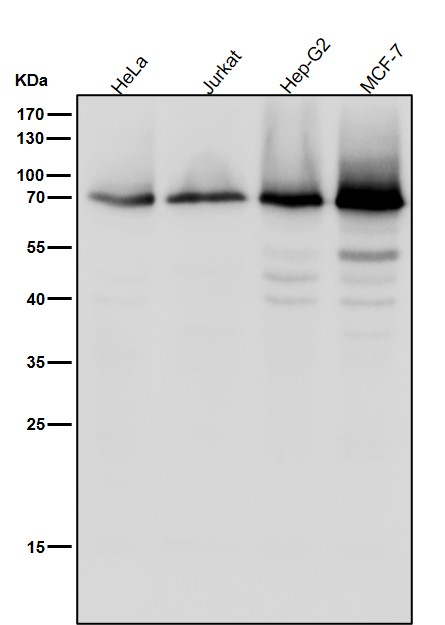 Rabbit Monoclonal to Phospho-PKC zeta(T560)