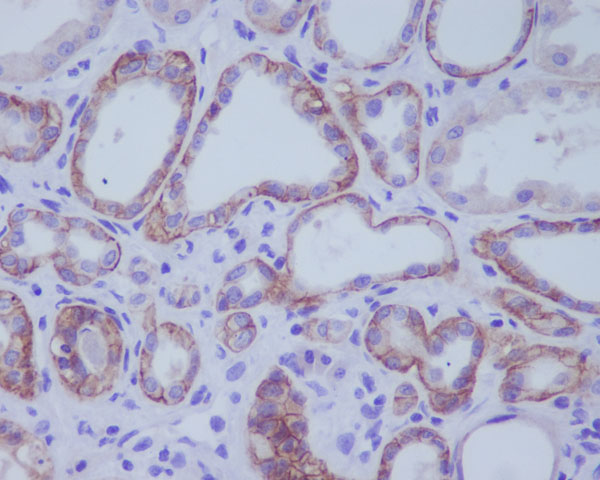 Rabbit Monoclonal to ACE2