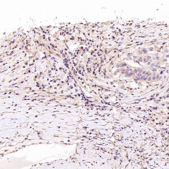 Rabbit Monoclonal to ACE2