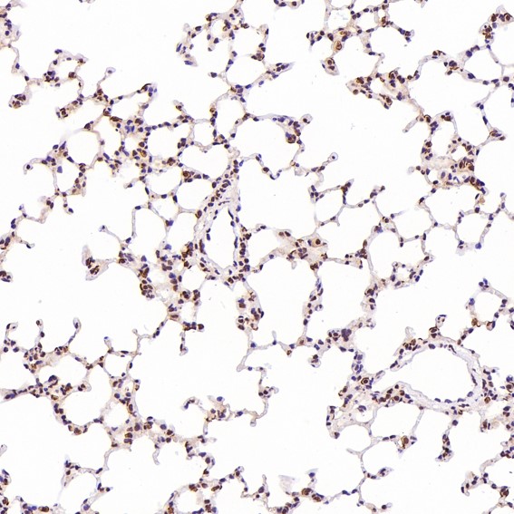 Rabbit Monoclonal to ACE2