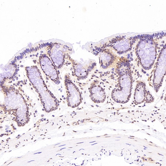 Rabbit Monoclonal to ACE2