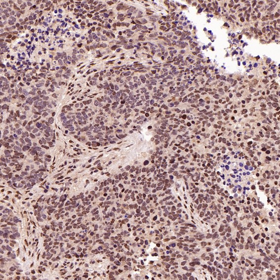 Rabbit Monoclonal to ACE2