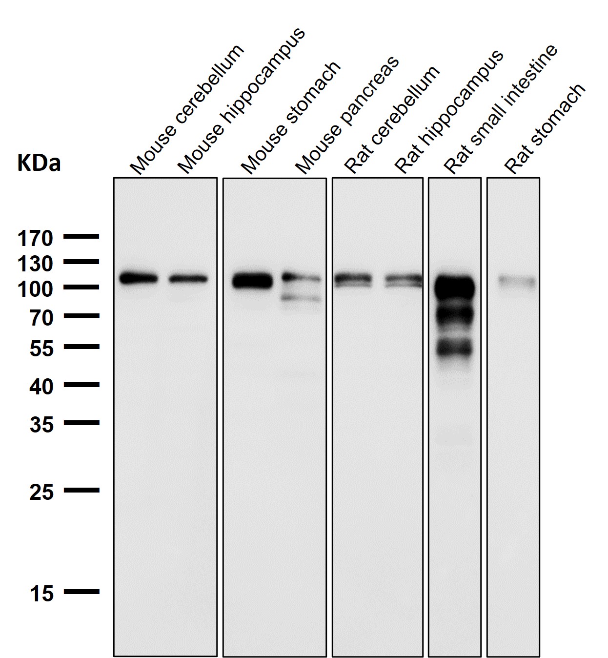Rabbit Monoclonal to ACE2