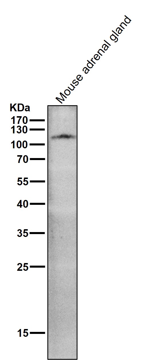 Rabbit Monoclonal to ACE2