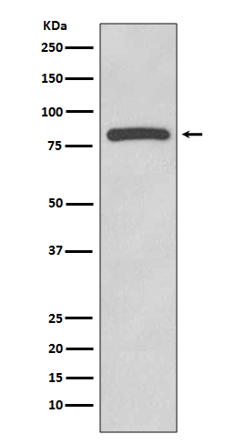 Glycogen synthase