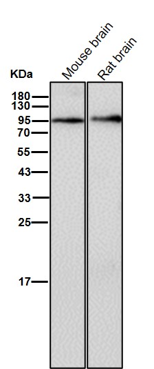 Rabbit Monoclonal to Glycogen synthase