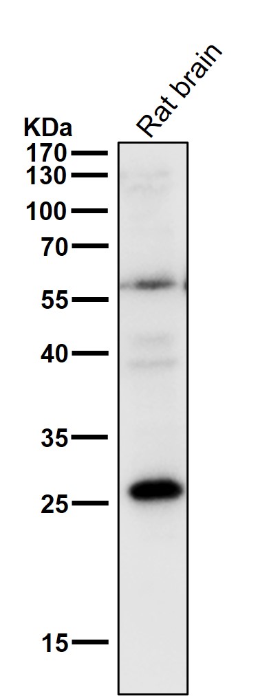 PPP1R1A