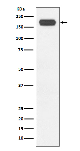 Rabbit Monoclonal to BRG1