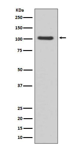 Rabbit Monoclonal to GluR1