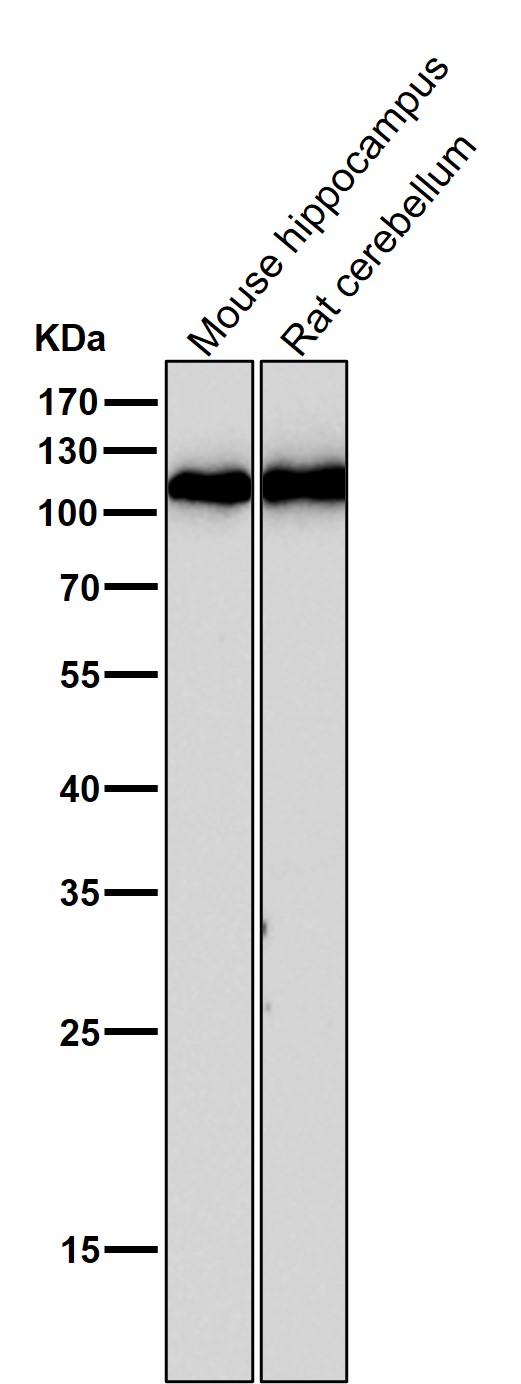 Rabbit Monoclonal to GluR1