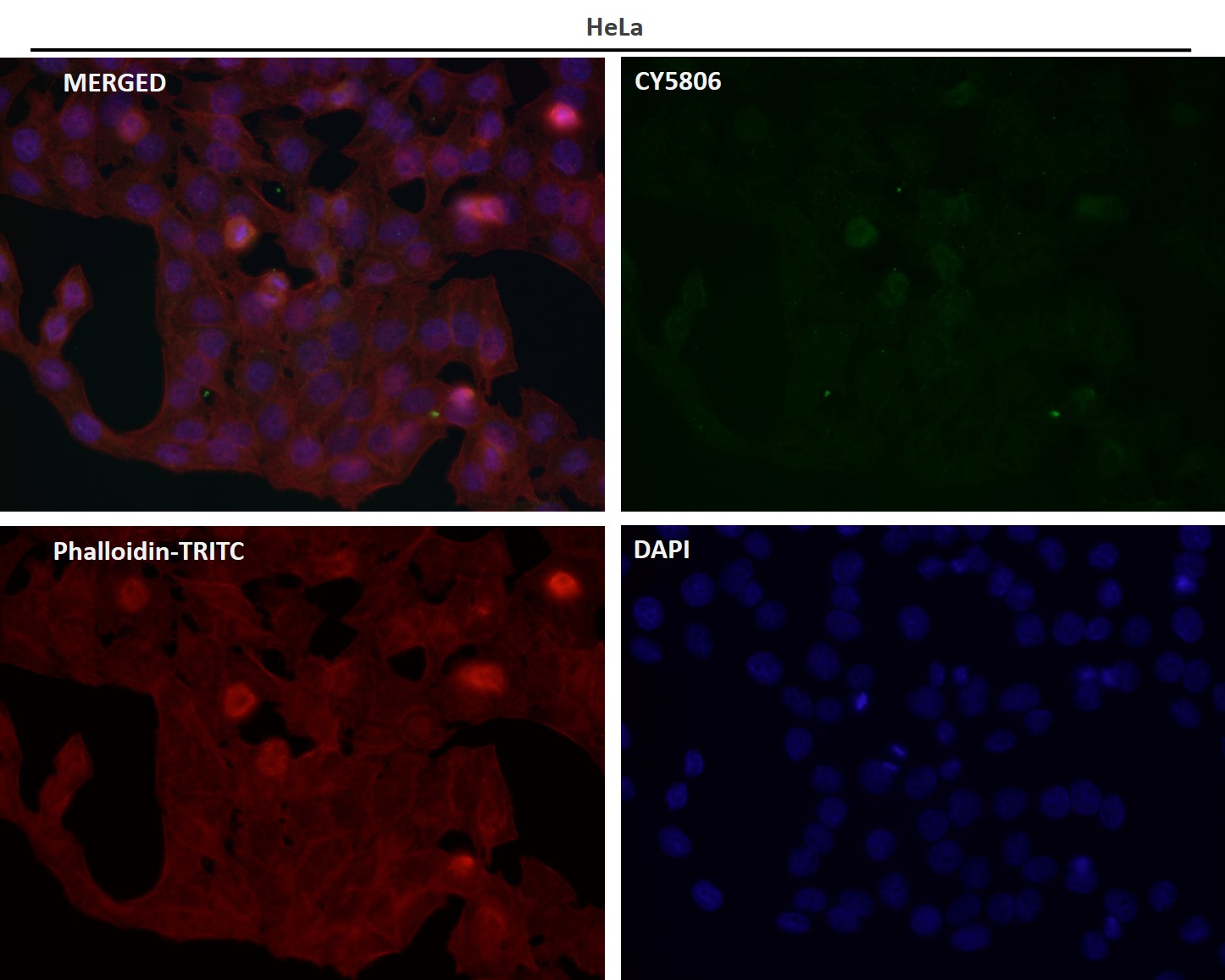 Rabbit Monoclonal to IRF5