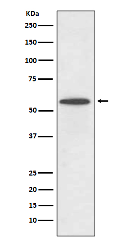Rabbit Monoclonal to IRF5