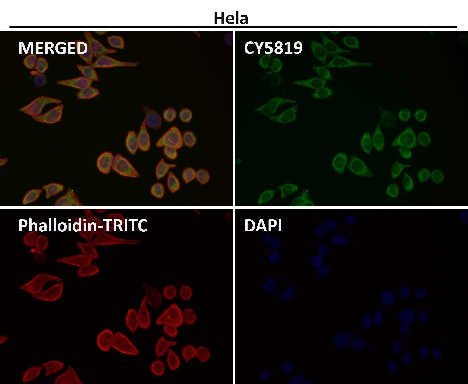 Rabbit Monoclonal to Cdk8