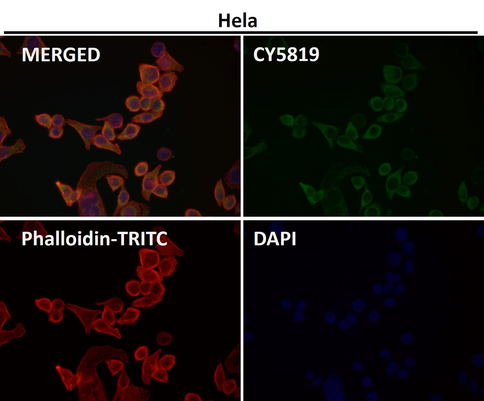 Rabbit Monoclonal to Cdk8