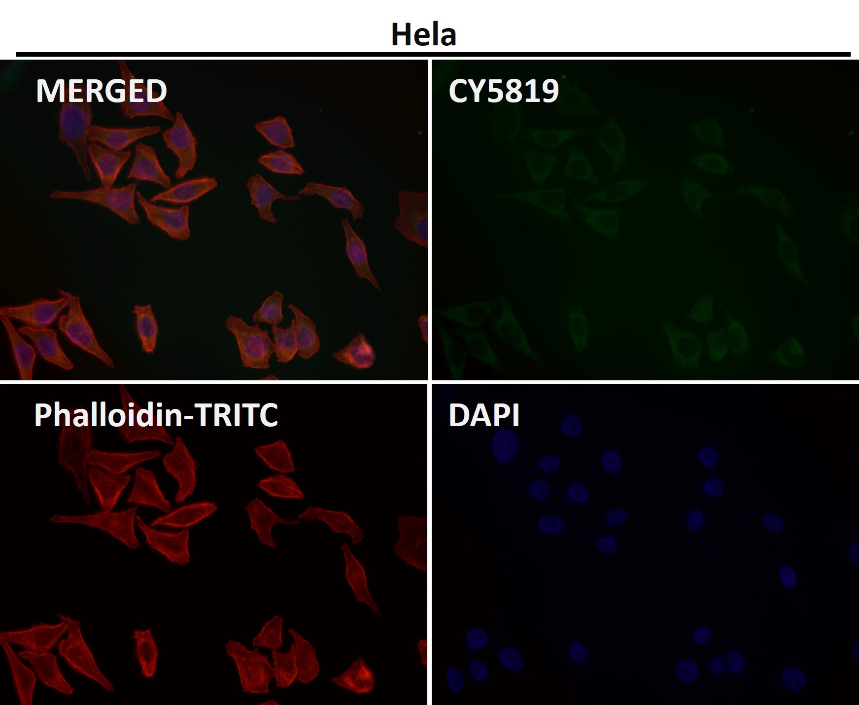 Rabbit Monoclonal to Cdk8