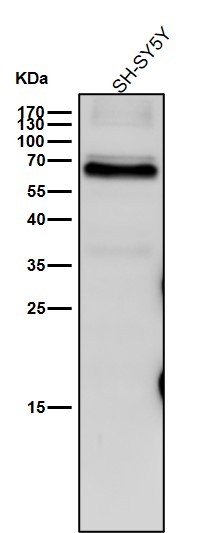 Rabbit Monoclonal to IRF5