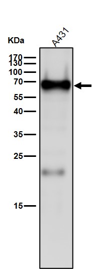Rabbit Monoclonal to IRF5