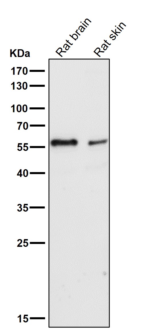 IRF5