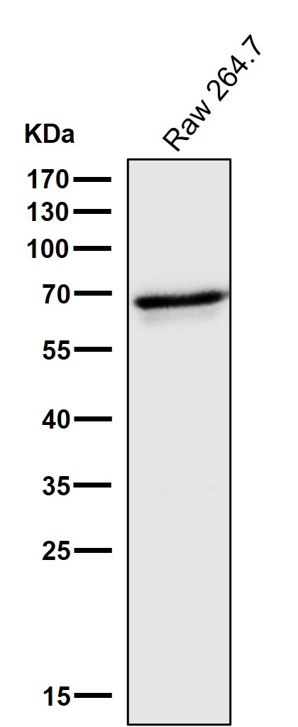 Rabbit Monoclonal to IRF5