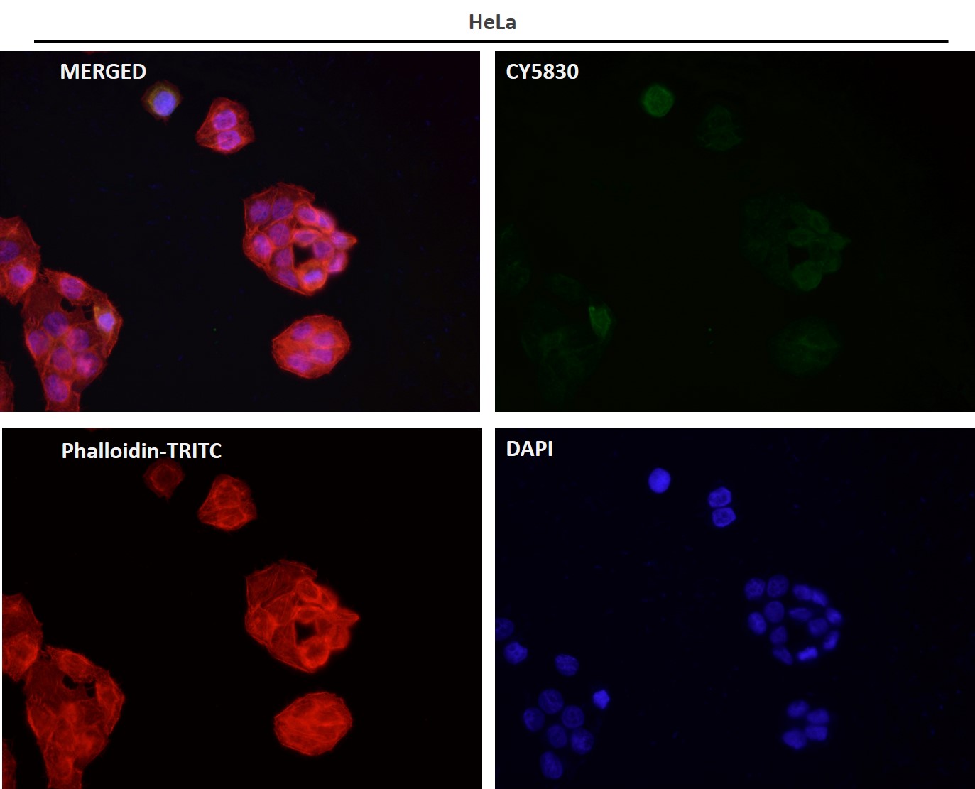 Rabbit Monoclonal to IRS1